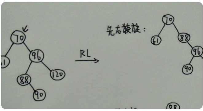什么是平衡二叉樹